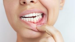 consecuencias del mal cuidado de las encías